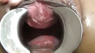 Asian speculum